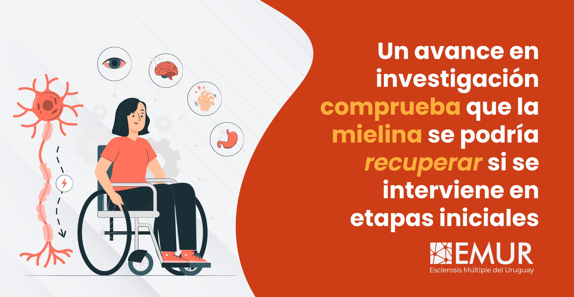 Un avance en investigación comprueba que la mielina se podría recuperar si se interviene en etapas iniciales.
